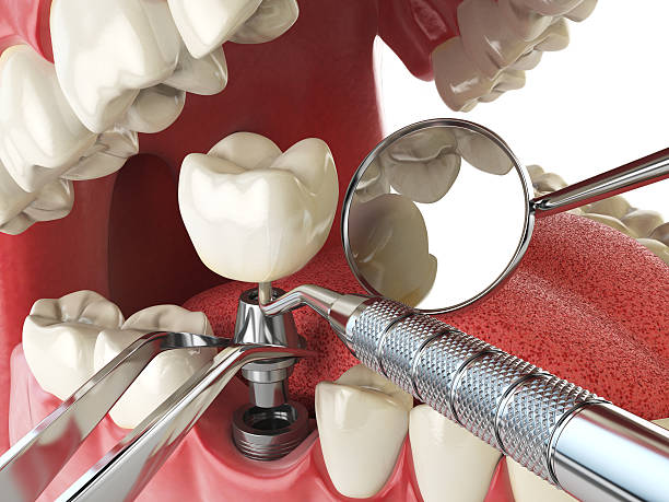 Best Emergency Cosmetic Dentistry in USA